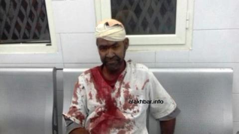 أحد المصابين في النزاع مساء أمس بعيد تلقيه العلاج في مستشفى الشيخ زايد بنواكشوط